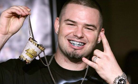 Hip-Hop Fashion Accessories, Grills (Extravagant Teeth Crowns)